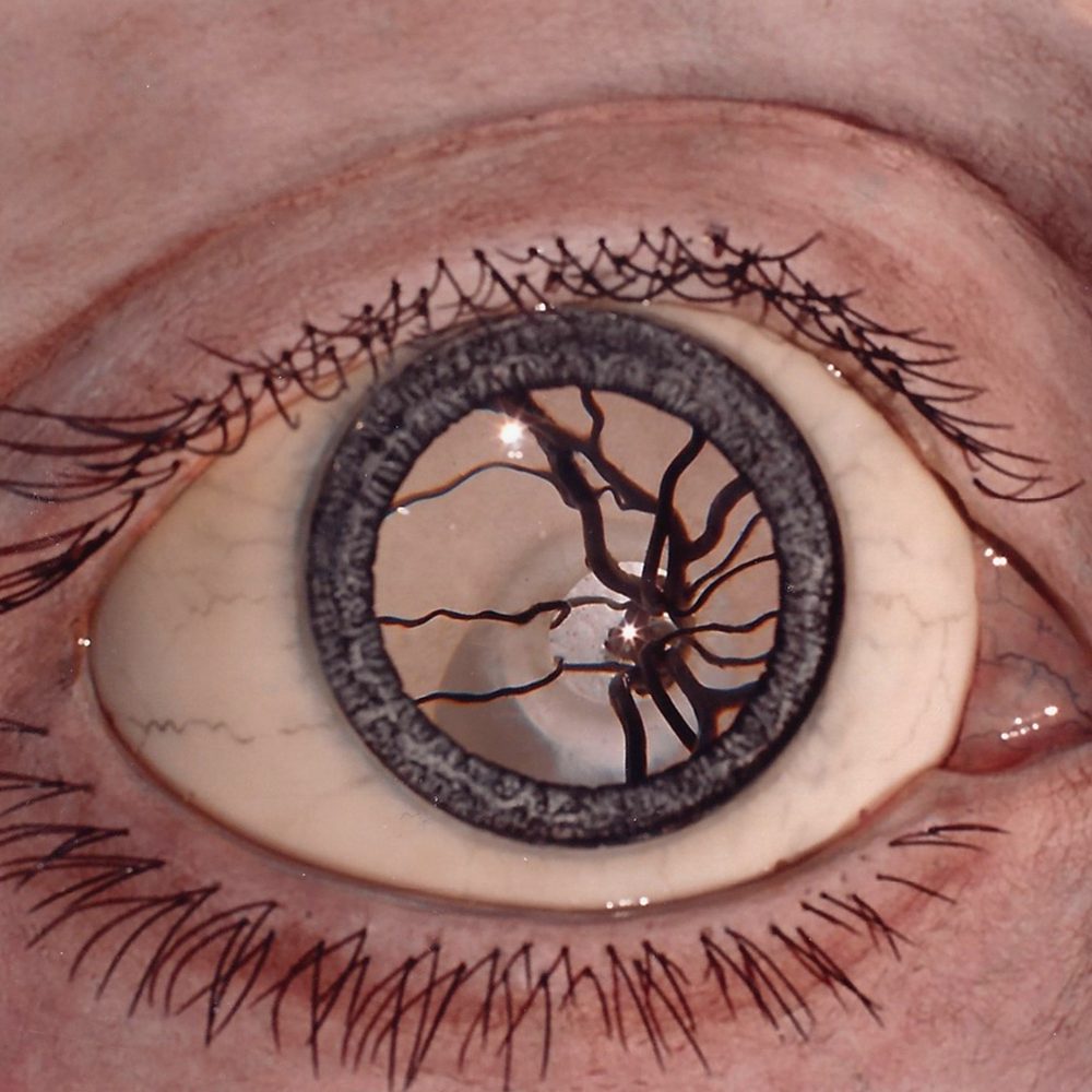 Auge 10:1 Augenhintergrund